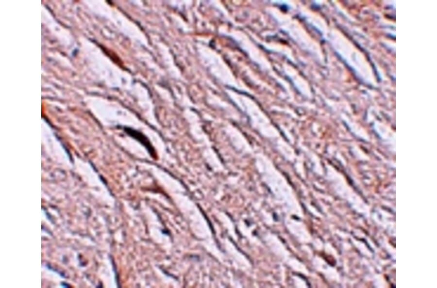 Immunohistochemistry - ZIP2 Antibody from Signalway Antibody (25225) - Antibodies.com