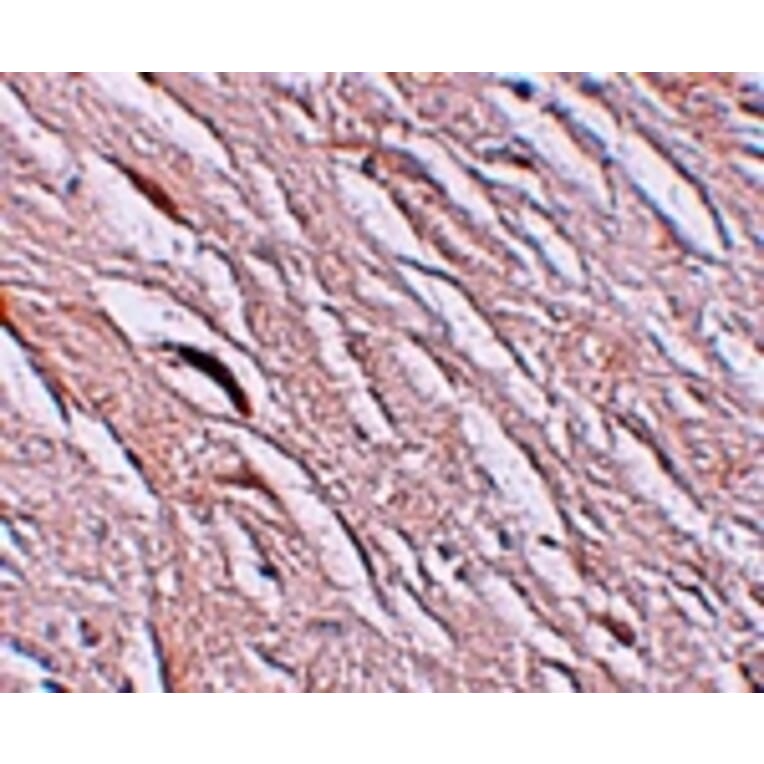 Immunohistochemistry - ZIP2 Antibody from Signalway Antibody (25225) - Antibodies.com