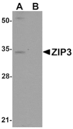 Western blot - ZIP3 Antibody from Signalway Antibody (25226) - Antibodies.com