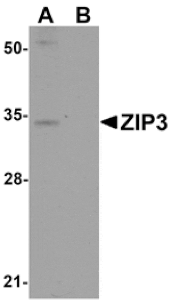 Western blot - ZIP3 Antibody from Signalway Antibody (25226) - Antibodies.com