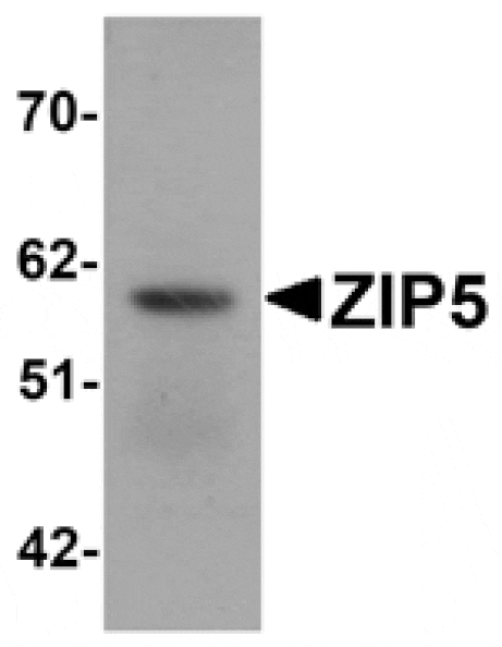 Western blot - ZIP5 Antibody from Signalway Antibody (25228) - Antibodies.com
