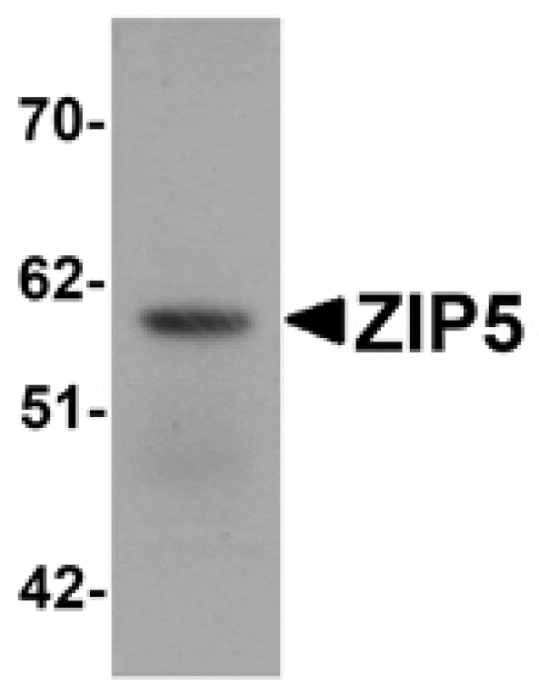 Western blot - ZIP5 Antibody from Signalway Antibody (25228) - Antibodies.com