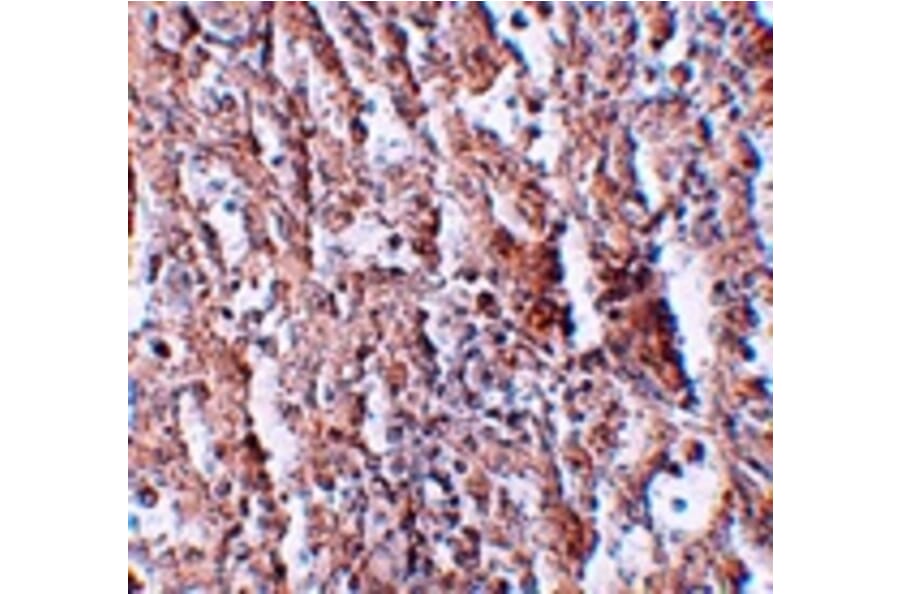 Immunohistochemistry - ZIP5 Antibody from Signalway Antibody (25228) - Antibodies.com