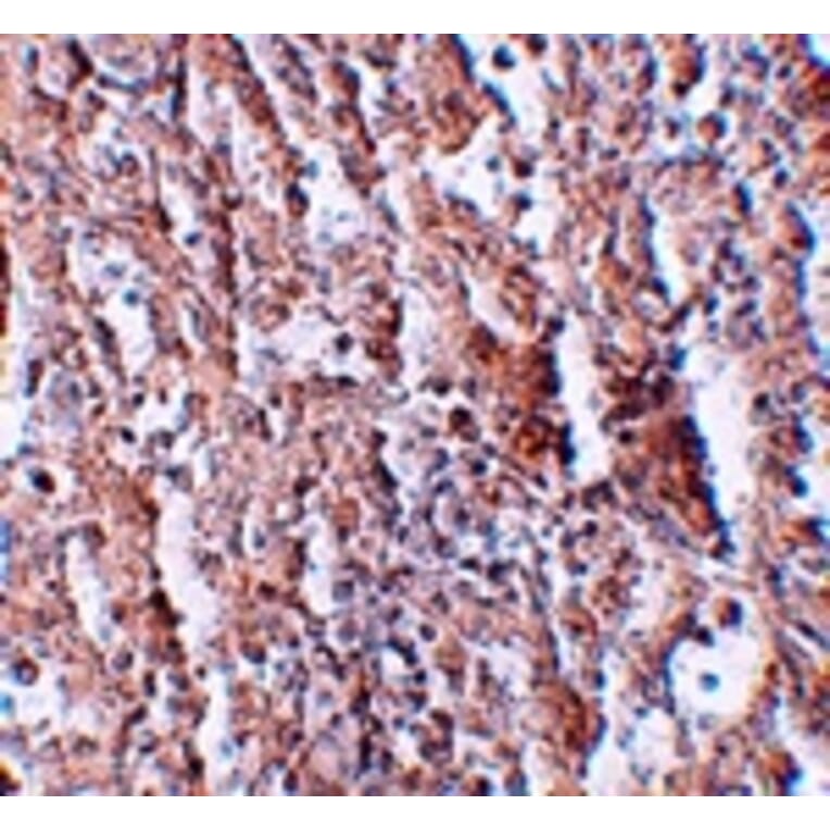 Immunohistochemistry - ZIP5 Antibody from Signalway Antibody (25228) - Antibodies.com