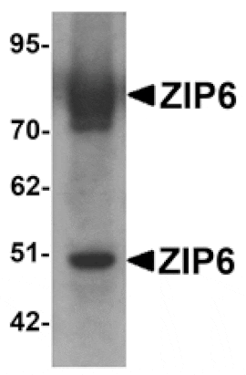 Western blot - ZIP6 Antibody from Signalway Antibody (25229) - Antibodies.com