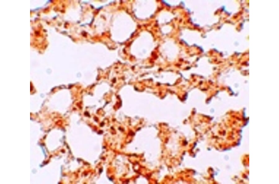 Immunohistochemistry - ZIP6 Antibody from Signalway Antibody (25229) - Antibodies.com