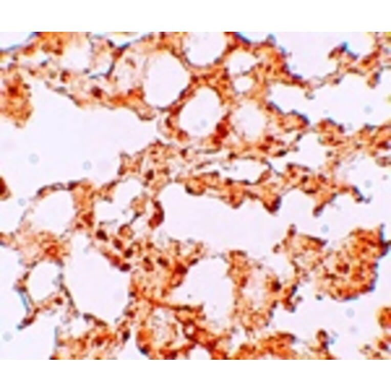 Immunohistochemistry - ZIP6 Antibody from Signalway Antibody (25229) - Antibodies.com