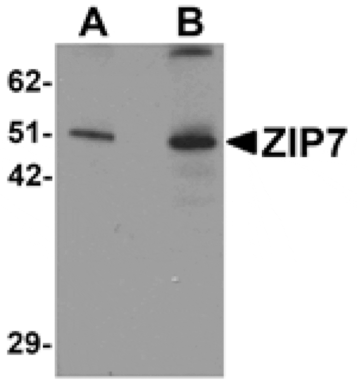 Western blot - ZIP7 Antibody from Signalway Antibody (25230) - Antibodies.com