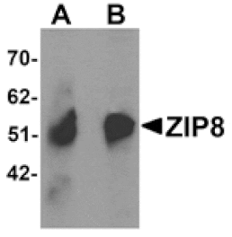 Western blot - ZIP8 Antibody from Signalway Antibody (25231) - Antibodies.com