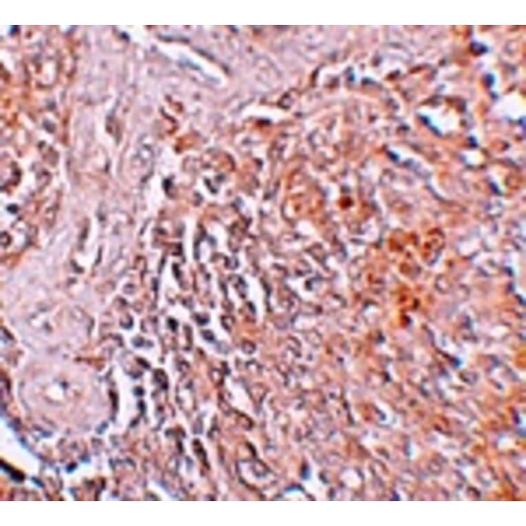 Immunohistochemistry - ZIP8 Antibody from Signalway Antibody (25231) - Antibodies.com