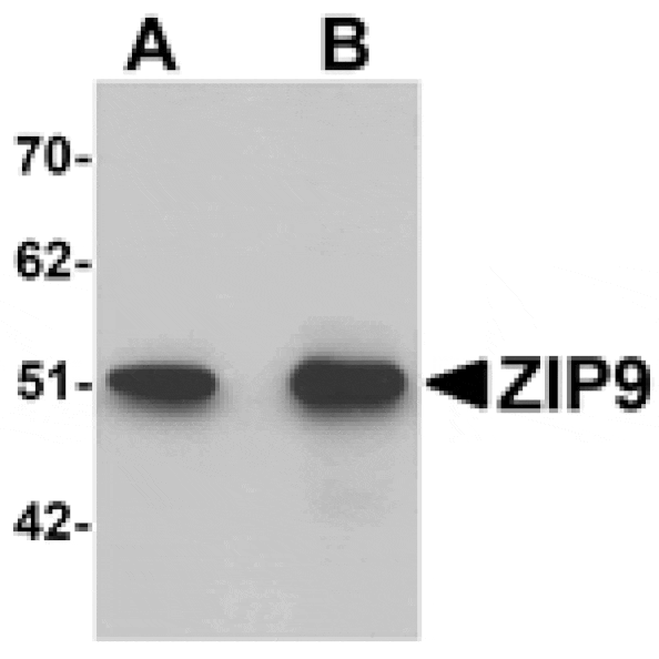 Western blot - ZIP9 Antibody from Signalway Antibody (25232) - Antibodies.com