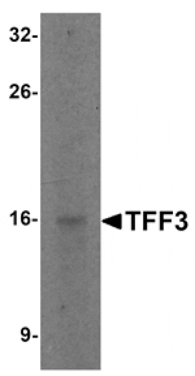 Western blot - TFF3 Antibody from Signalway Antibody (25240) - Antibodies.com