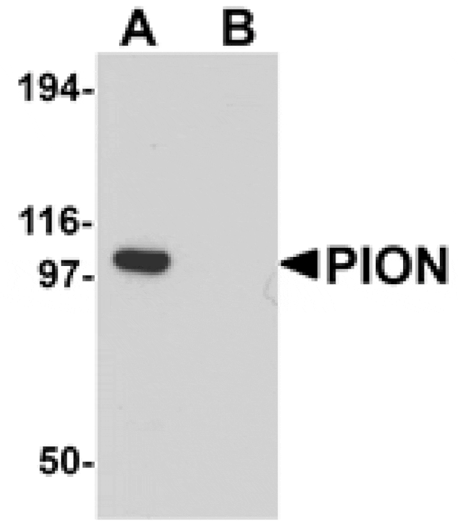 Western blot - PION Antibody from Signalway Antibody (25252) - Antibodies.com