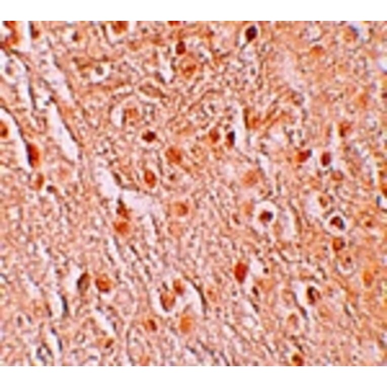 Immunohistochemistry - PION Antibody from Signalway Antibody (25252) - Antibodies.com