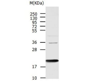 AGR2 Antibody from Signalway Antibody (31005) - Antibodies.com