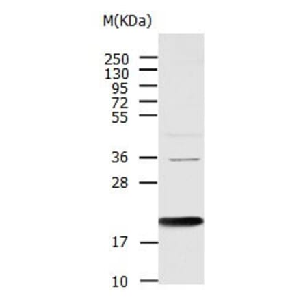 AGR2 Antibody from Signalway Antibody (31005) - Antibodies.com