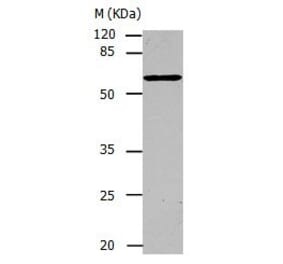 CAP1 Antibody from Signalway Antibody (31042) - Antibodies.com