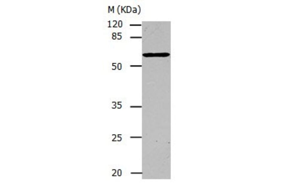 CAP1 Antibody from Signalway Antibody (31042) - Antibodies.com