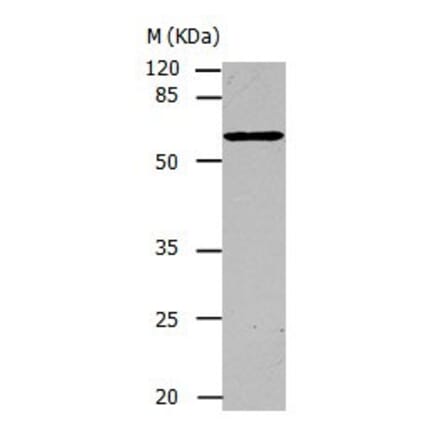 CAP1 Antibody from Signalway Antibody (31042) - Antibodies.com