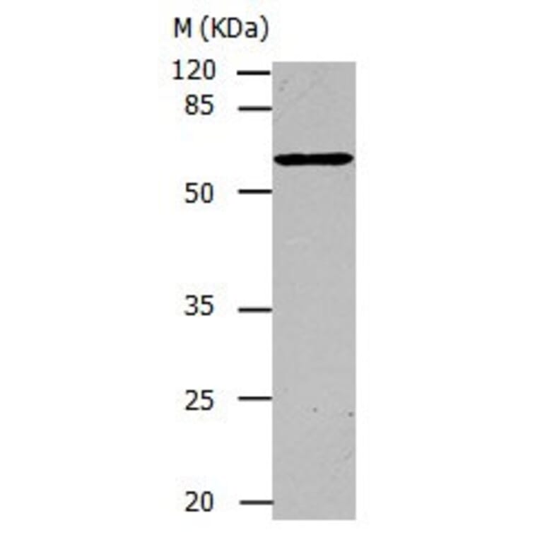 CAP1 Antibody from Signalway Antibody (31042) - Antibodies.com
