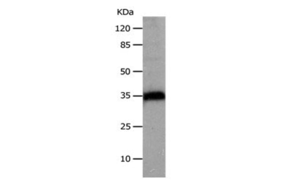CTSZ Antibody from Signalway Antibody (31047) - Antibodies.com