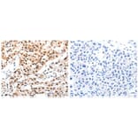 CBX8 Antibody from Signalway Antibody (31048) - Antibodies.com