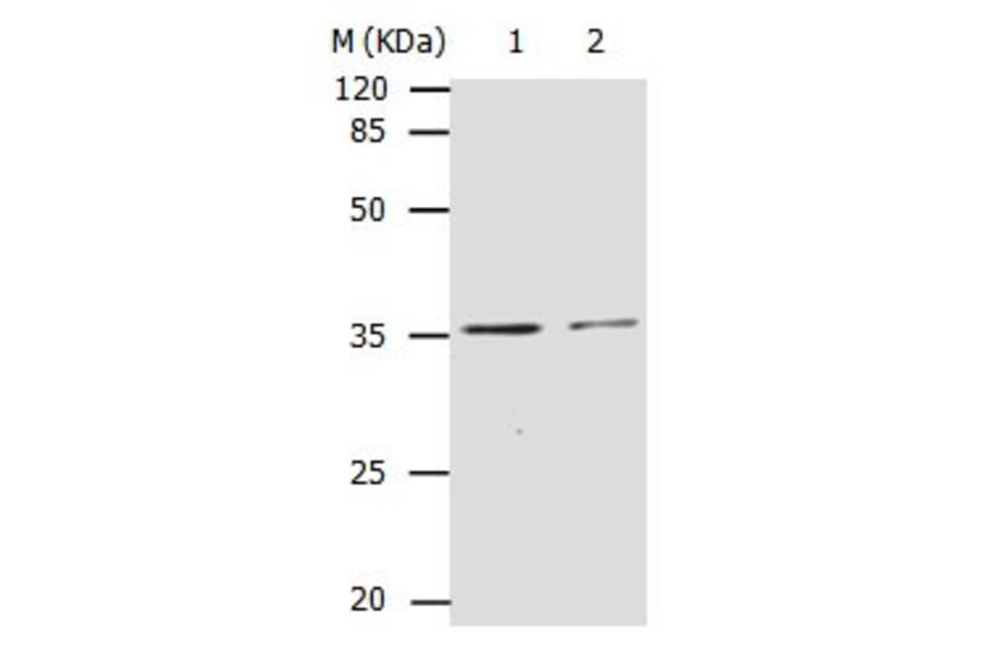 CDK4 Antibody from Signalway Antibody (31053) - Antibodies.com