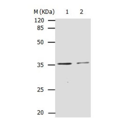CDK4 Antibody from Signalway Antibody (31053) - Antibodies.com