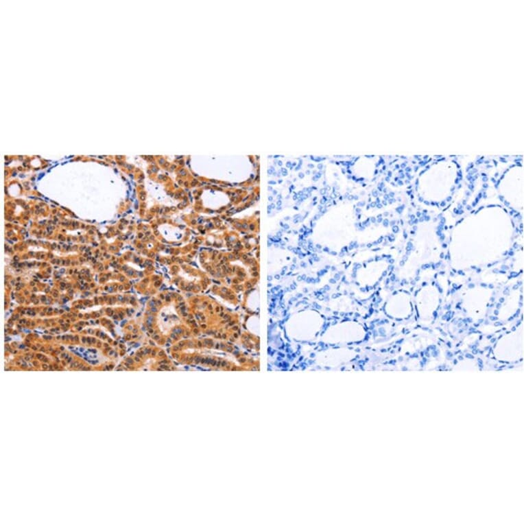 CDK4 Antibody from Signalway Antibody (31053) - Antibodies.com
