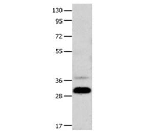 CDK5 Antibody from Signalway Antibody (31054) - Antibodies.com