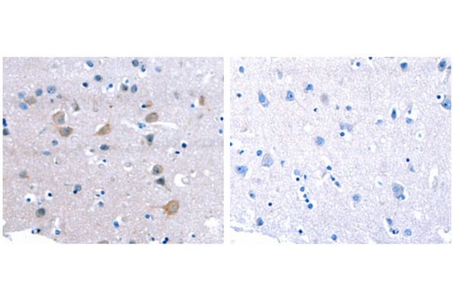 CDK5 Antibody from Signalway Antibody (31054) - Antibodies.com