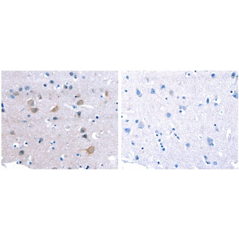 CDK5 Antibody from Signalway Antibody (31054) - Antibodies.com
