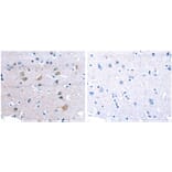 CDK5 Antibody from Signalway Antibody (31054) - Antibodies.com
