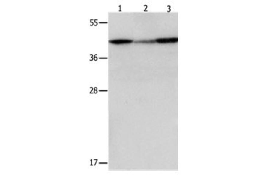 DAP3 Antibody from Signalway Antibody (31066) - Antibodies.com