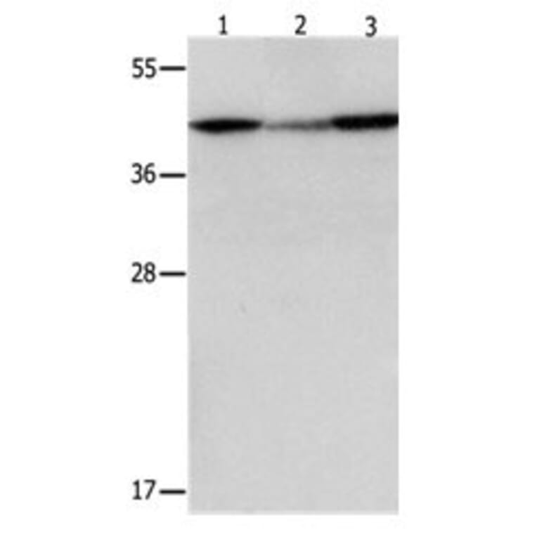 DAP3 Antibody from Signalway Antibody (31066) - Antibodies.com