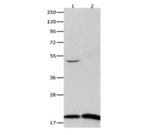 FHIT Antibody from Signalway Antibody (31073) - Antibodies.com