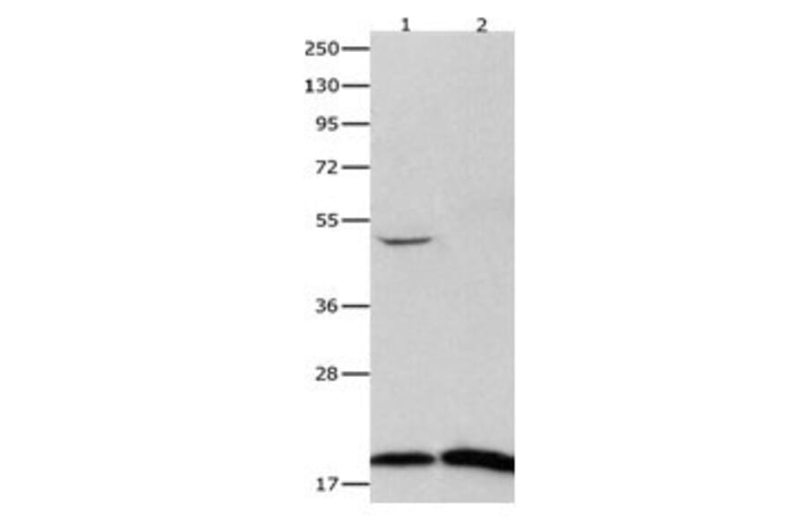 FHIT Antibody from Signalway Antibody (31073) - Antibodies.com