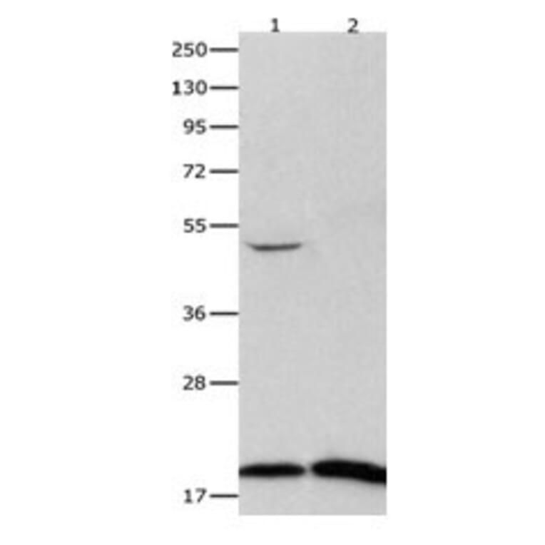 FHIT Antibody from Signalway Antibody (31073) - Antibodies.com