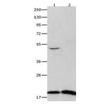 FHIT Antibody from Signalway Antibody (31073) - Antibodies.com