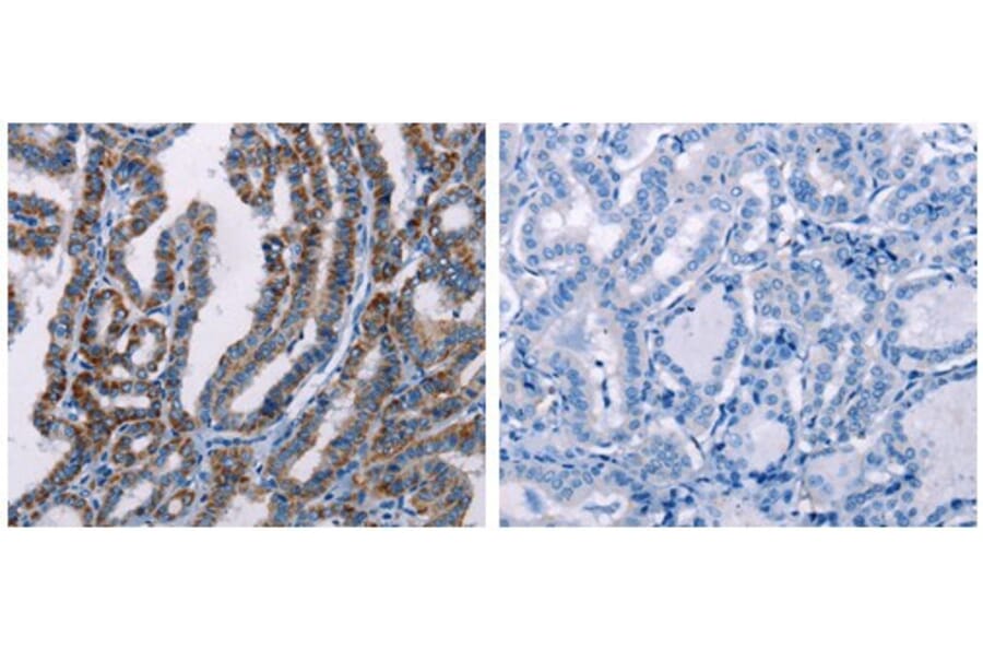 FHIT Antibody from Signalway Antibody (31073) - Antibodies.com