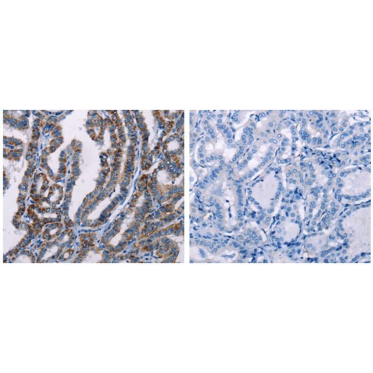 FHIT Antibody from Signalway Antibody (31073) - Antibodies.com