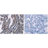 FHIT Antibody from Signalway Antibody (31073) - Antibodies.com