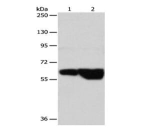 GRK4 Antibody from Signalway Antibody (31076) - Antibodies.com