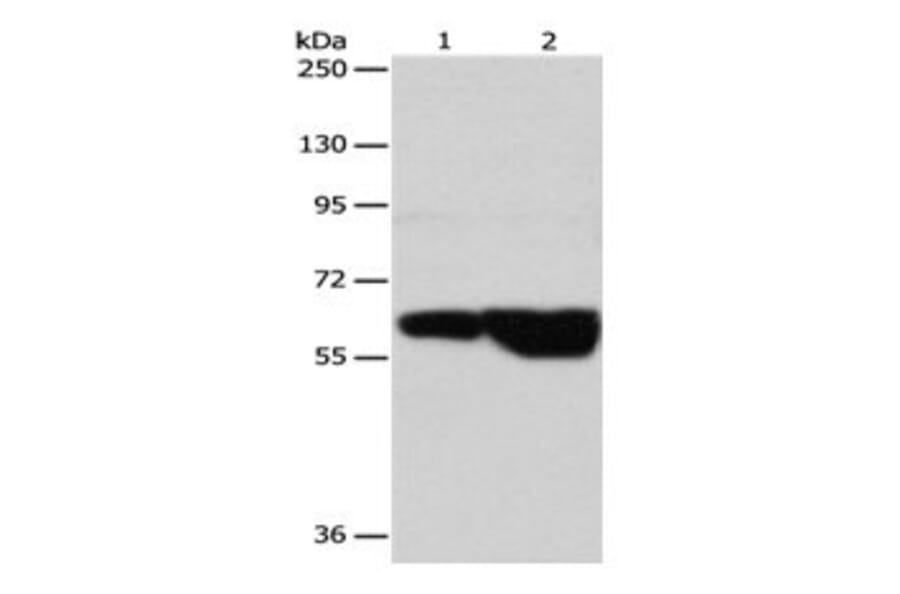GRK4 Antibody from Signalway Antibody (31076) - Antibodies.com