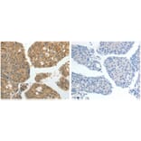 GRK4 Antibody from Signalway Antibody (31076) - Antibodies.com