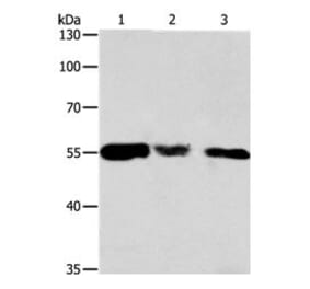 CALR Antibody from Signalway Antibody (31077) - Antibodies.com