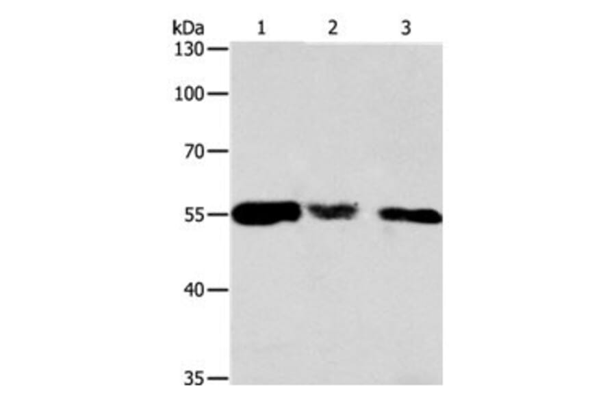 CALR Antibody from Signalway Antibody (31077) - Antibodies.com
