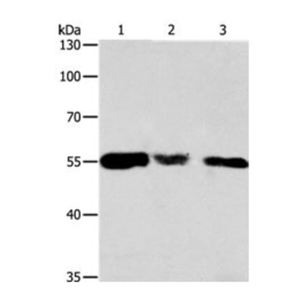 CALR Antibody from Signalway Antibody (31077) - Antibodies.com