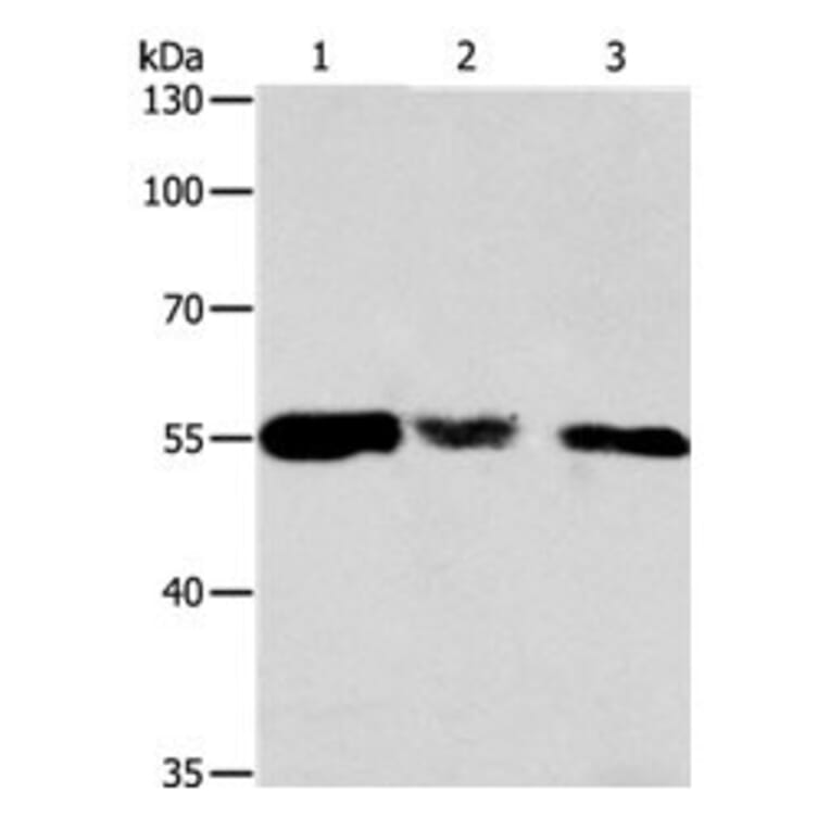 CALR Antibody from Signalway Antibody (31077) - Antibodies.com