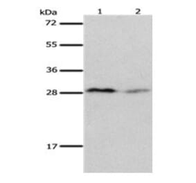 KLK7 Antibody from Signalway Antibody (31093) - Antibodies.com